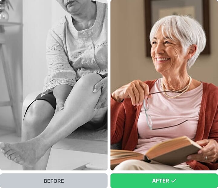 Elderly woman with swollen, painful legs