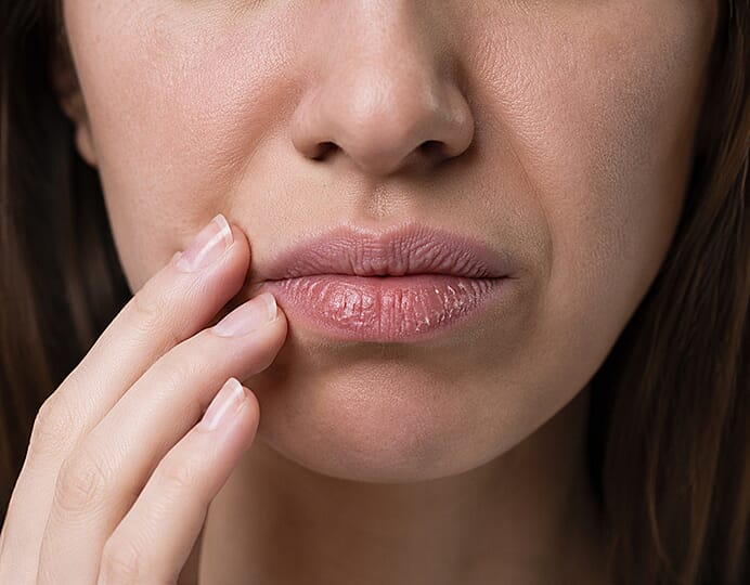 Lip concerns before treatment
