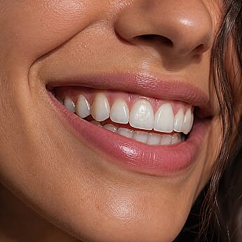 Dental devices