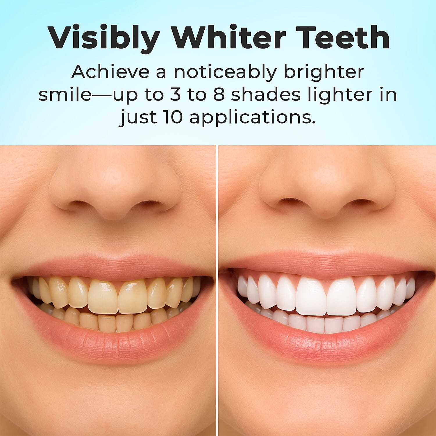 Opatra- Teeth Whitening System With 2 Extra Whitening Gels