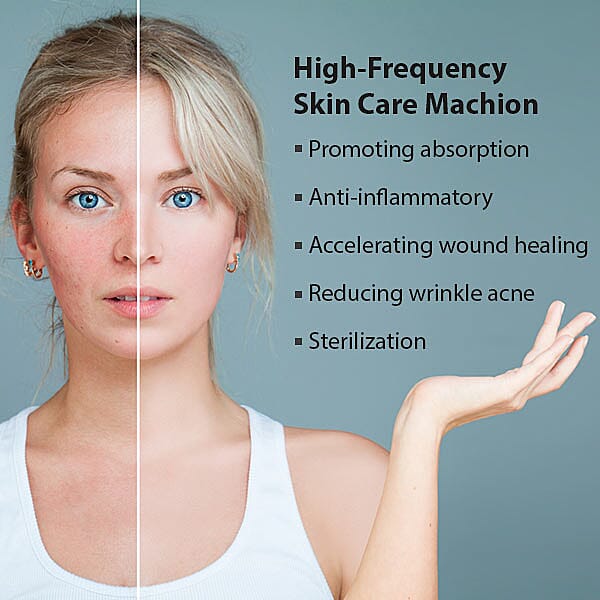 High Frequency Facial Skin Care Device (Size 34x21 Cm)
