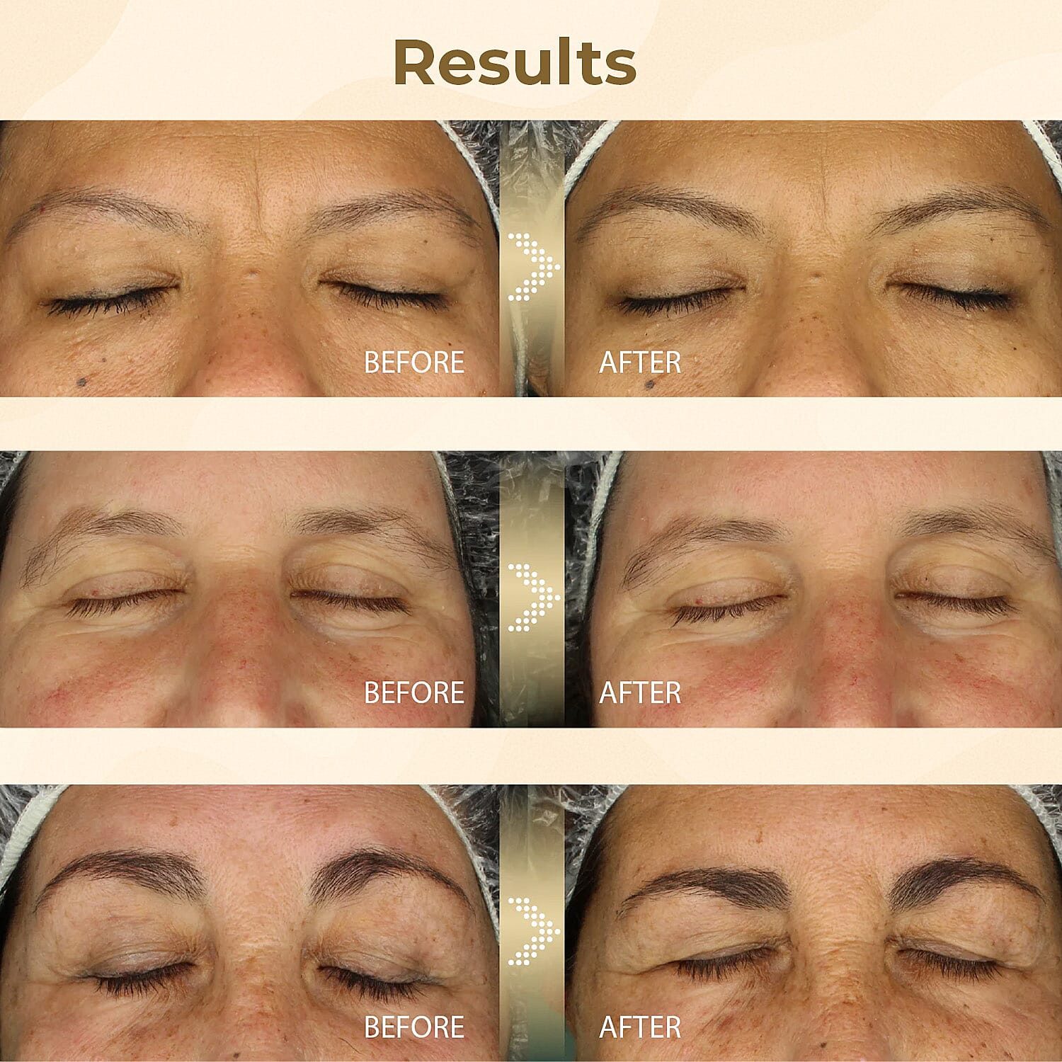 Opatra- Hands-Free i-Brow