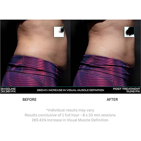 Last in Stock- Lunamour Nufit Pro LED - Far Infra-Red EMS Slimming Belt (Exclusive Lifetime Warranty)