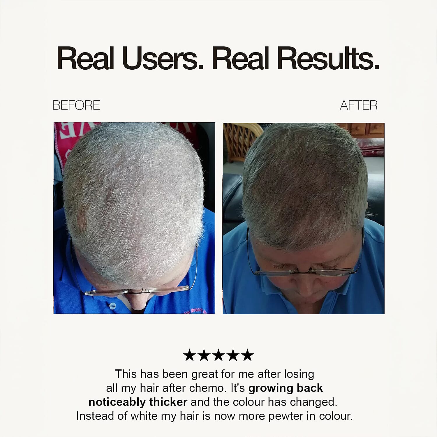 Opatra Lumicap Pro - Light Therapy for Hair Growth - 88 Lights - with Lifetime Warranty