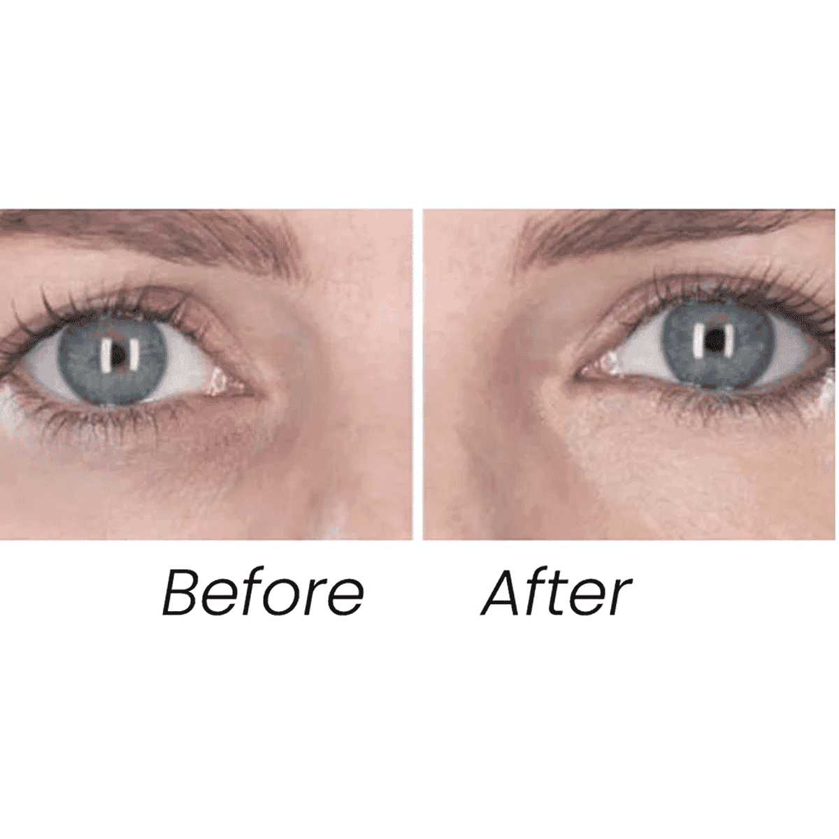 Transformulas FlawLess EyeRetouch Serum 2 IN 1 ANTI-AGEING SMART TONE SERUM CONCEALER Transformulas FlawLess EyeRetouch Serum 2 IN 1 ANTI-AGEING SMART TONE SERUM CONCEALER