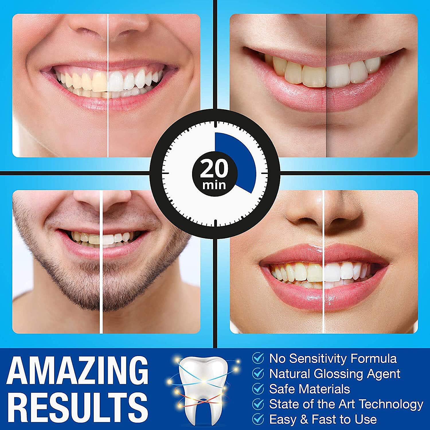 Pro Intellident Teeth Whitening Kit with LED Light