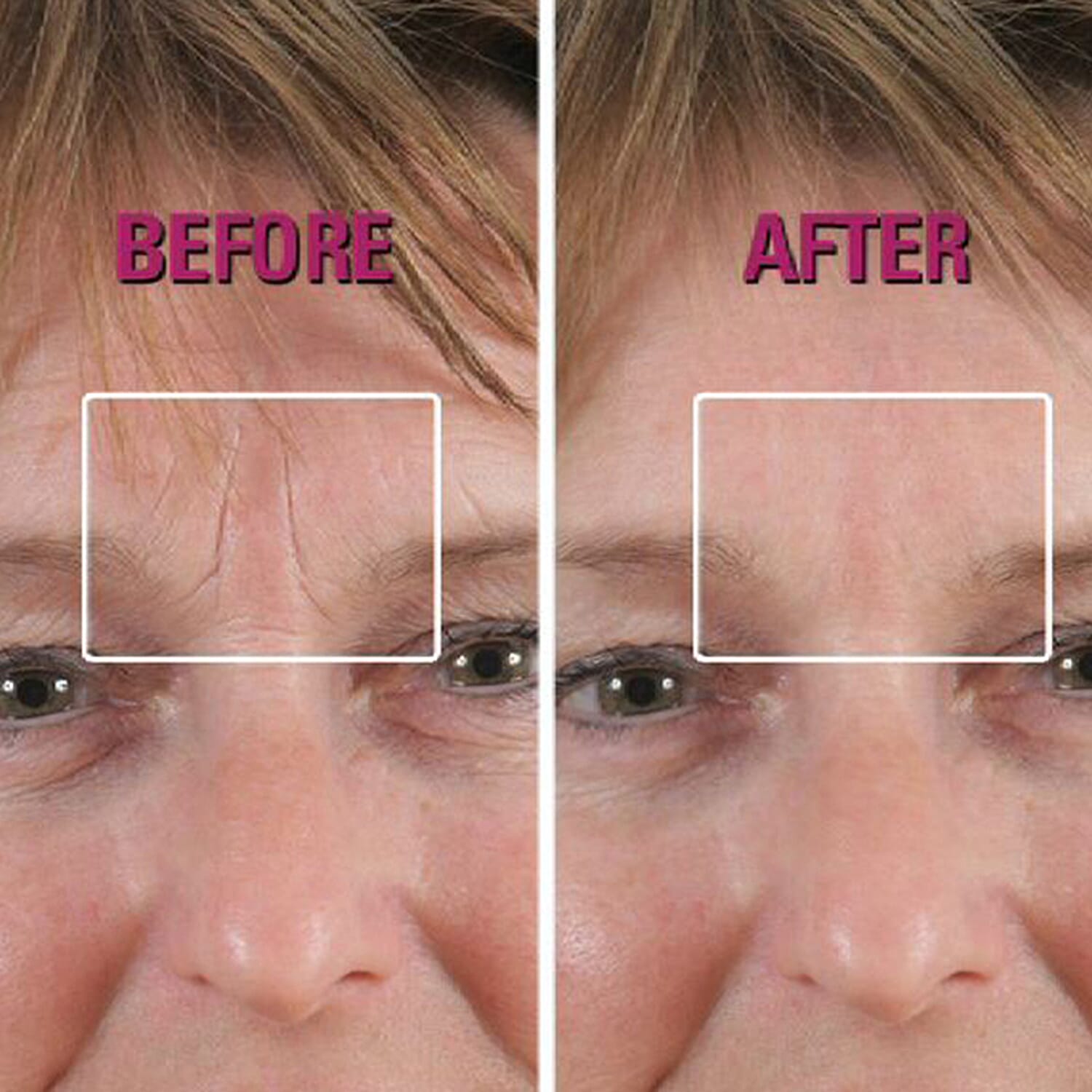 SKINEANCE Wrinkle Filler - Fills and Smoothes Fine Lines & Wrinkles Immediately - 15ml