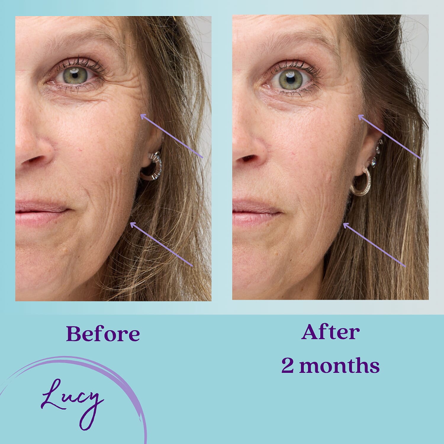 GALA PRICE - One Truth 818- Anti-Ageing Serum - 50ml