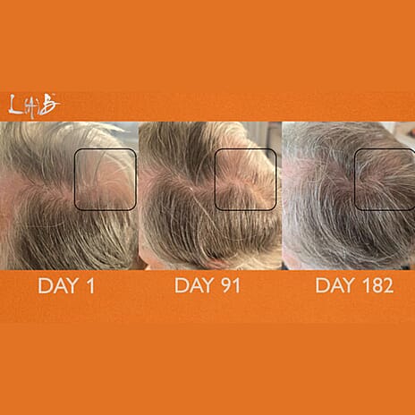 Lab Life INCREMENTUM LED Hairbrush with 72 Pure Sourced LED Lights - Lifetime Warranty