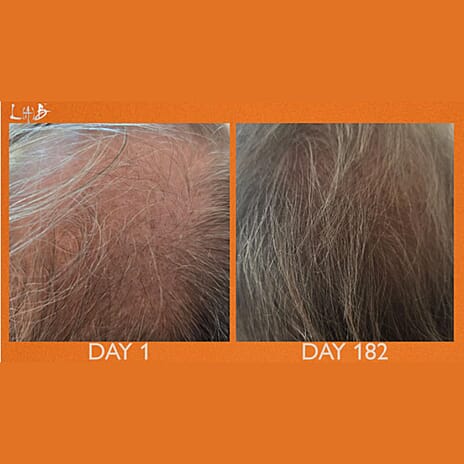 Lab Life INCREMENTUM LED Hairbrush with 72 Pure Sourced LED Lights - Lifetime Warranty