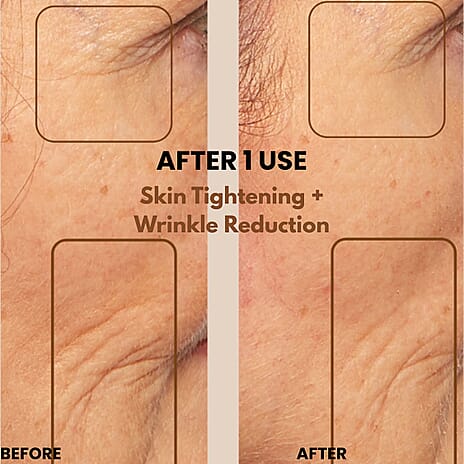 Lab Life Deciem - RF, LIF, MFIP and VR Technology (Lifetime Warranty)