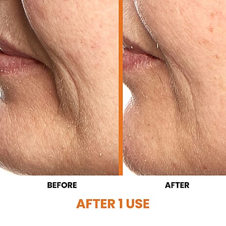 Lab Life Deciem - RF, LIF, MFIP and VR Technology (Lifetime Warranty)