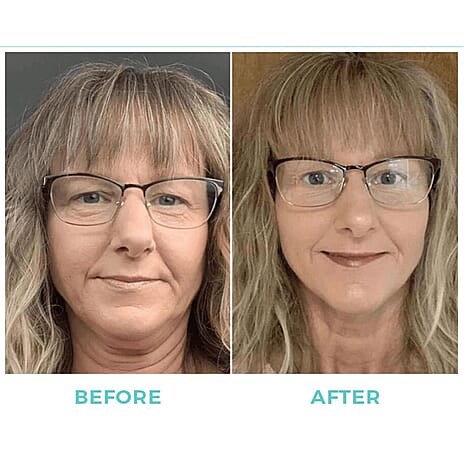 Beauty Gala New Launch - Nuovaluce 7 Colour LED Light Therapy Face Mask (With Exclusive Lifetime Warranty) with complementary Fabulift