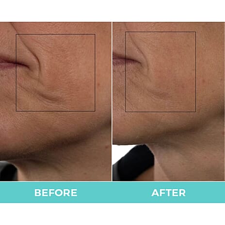 Beauty Gala New Launch - Nuovaluce 7 Colour LED Light Therapy Face Mask (With Exclusive Lifetime Warranty) with complementary Fabulift