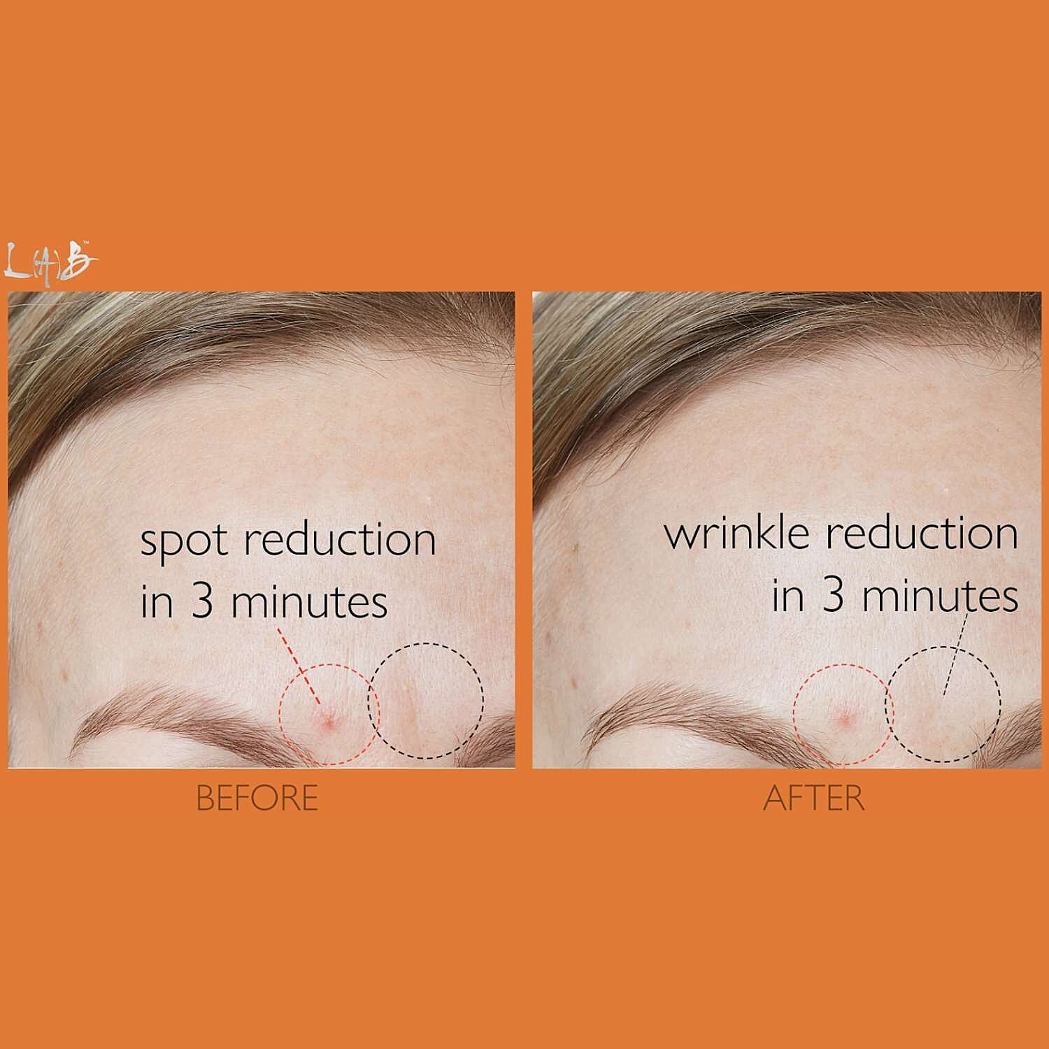 Black-Friday-Premiere-2025-Lab-Life-Beauty-Power-Patches-Pack-of-6