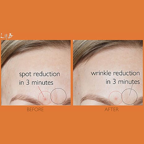 Black Friday Premiere 2025- Lab Life Beauty Power Patches - Pack of 6