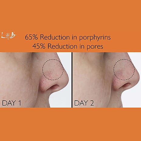 Black Friday Premiere 2025- Lab Life Beauty Power Patches - Pack of 6