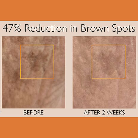 Black Friday Premiere 2025- Lab Life Beauty Power Patches - Pack of 6