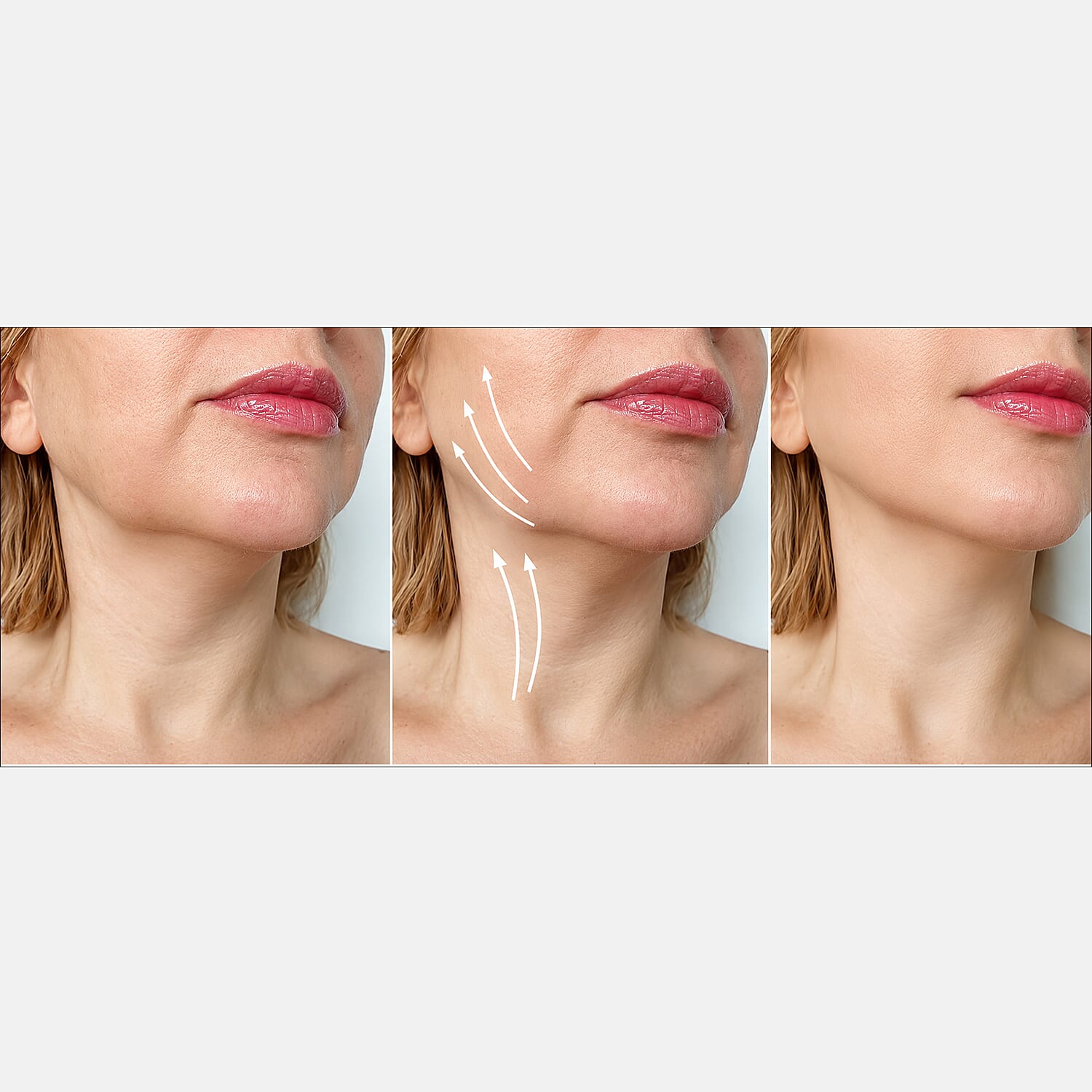 NEW LAUNCH- Chin Fit Elite with Photon Face-Lifting Technology & Infrared, RED & BLUE Light for Double Chin & Jawline