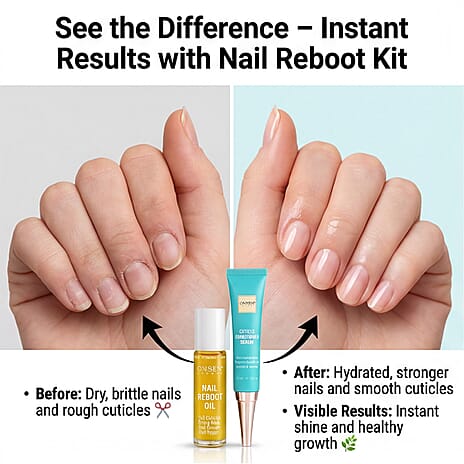 Essential Nail Reboot Challange Kit - includes Nail - Cuticle Conditioning Serum, Nail Reboot Oil, 3-Way Shining Buffer Block, Replacement Buffing Pads Kit, and Nail Reboot File (Grit 180-120)