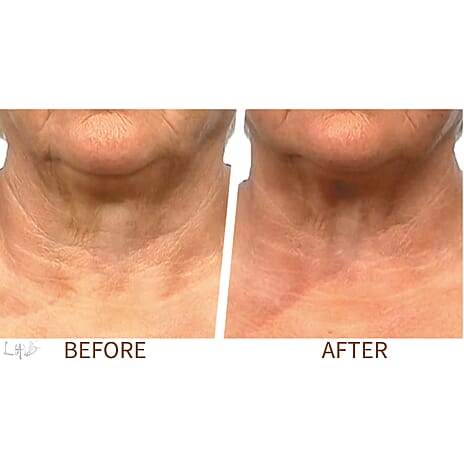 Lab Life Dermal De-Ageing Serum - The First Biomimetic Skincare