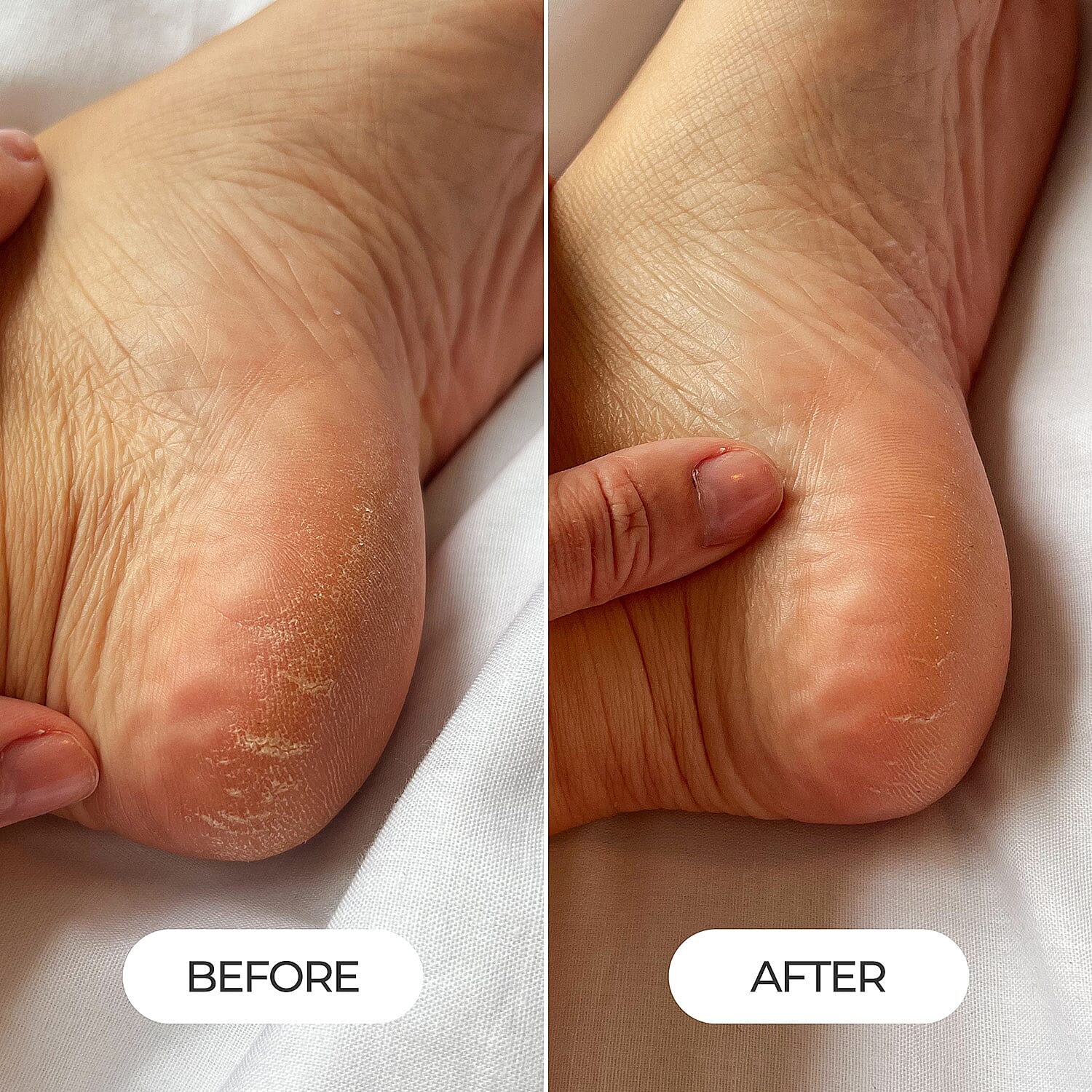 Dead Sea Dream Hand & Foot Cream Duo Bundle