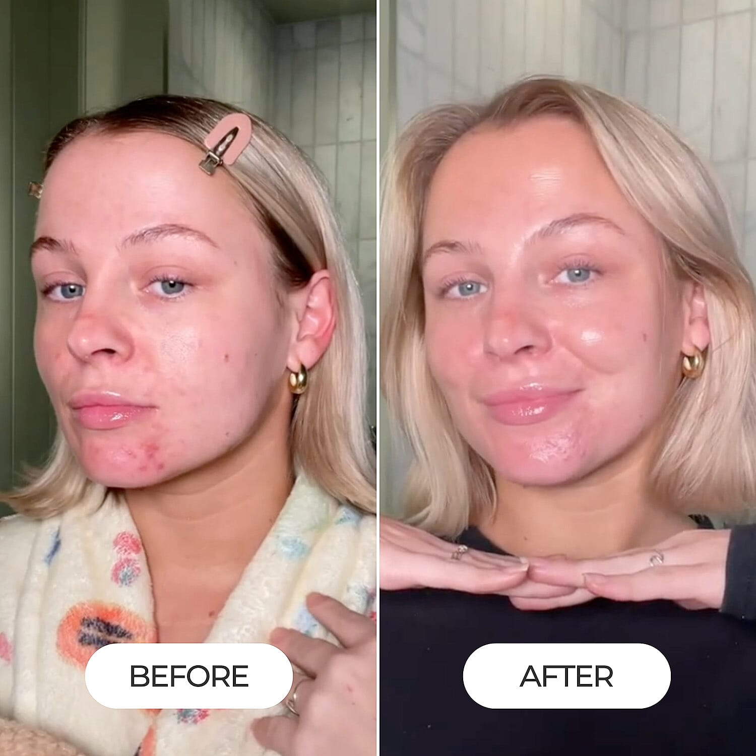 Dead Sea Dream Purity Mud Bar & Mud Mask Duo Bundle