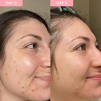 https://tjcuk.sirv.com/Products/86/6/8665080/Sand-Sky-Pro-Youth-Dark-Spot-Serum-30ml_8665080_3.jpg?w=342&h=342