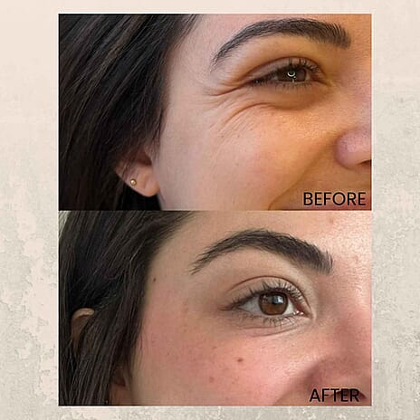 Super Saver Handpicked Ultimate Eye Care Bundle