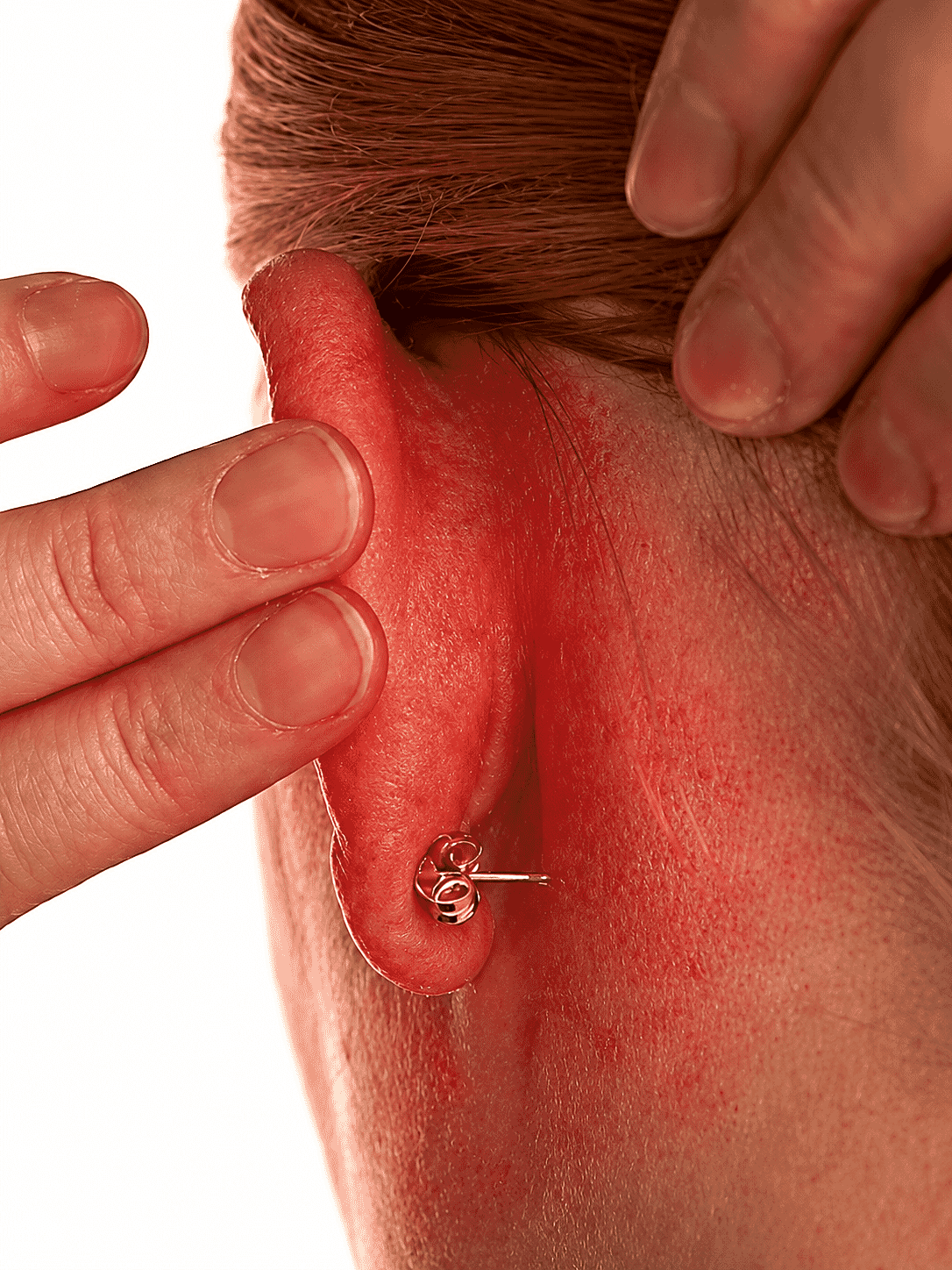 Red, itchy, sore, irritated ears