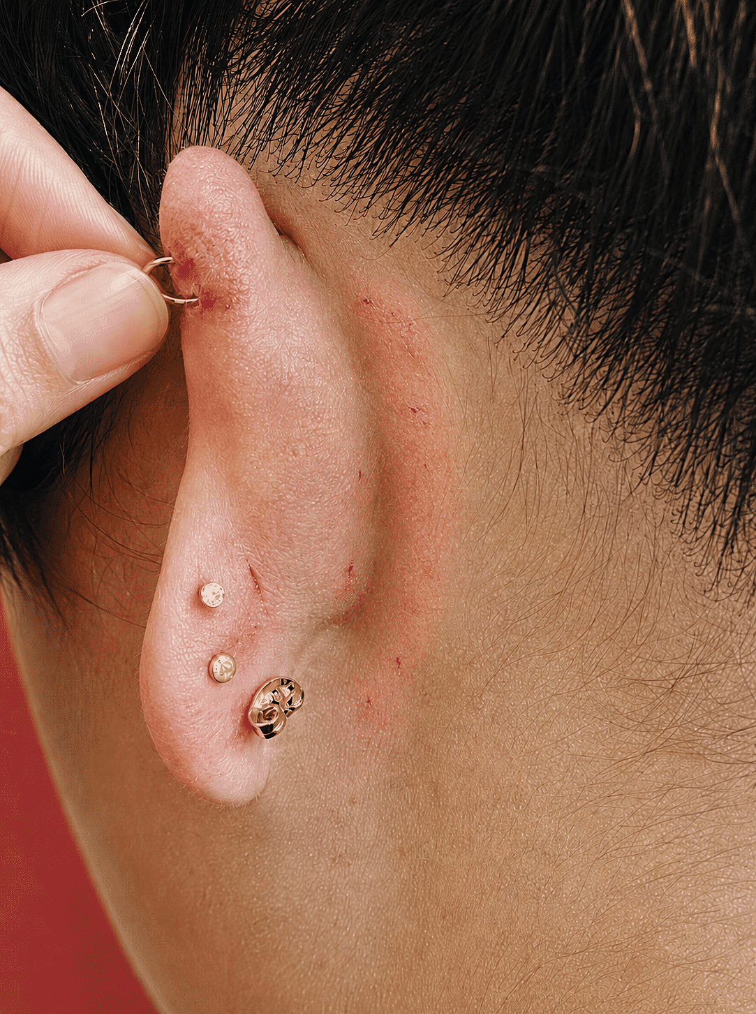 Frequent snags, small wounds